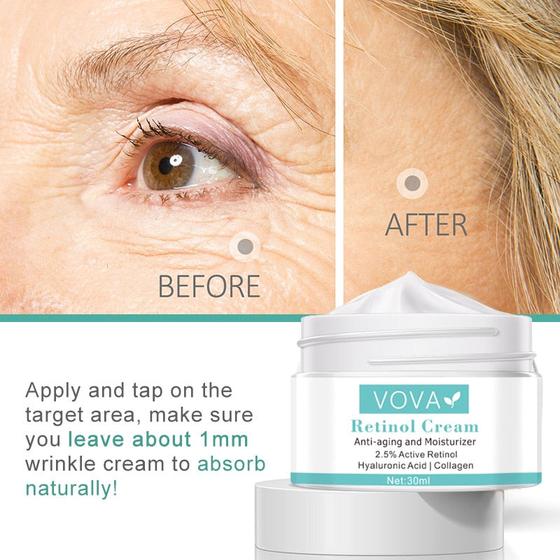 VOVA Retinol Anti Wrinkle Face Cream Collagen / Hyaluronic Acid / Retinol Improves Skin tone / FREE Shipping