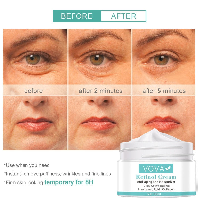 VOVA Retinol Anti Wrinkle Face Cream Collagen / Hyaluronic Acid / Retinol Improves Skin tone / FREE Shipping