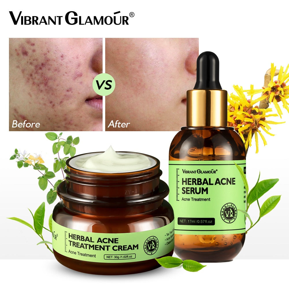 VIBRANT GLAMOUR Herbal Facial Skin Care 2PCS/Set Face Cream Serum Acne Treatment / FREE Shipping