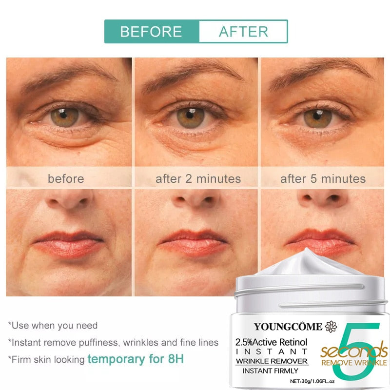 Retinol Anti-Wrinkle Cream Instant Anti Aging / Moisturizing / FREE Shipping