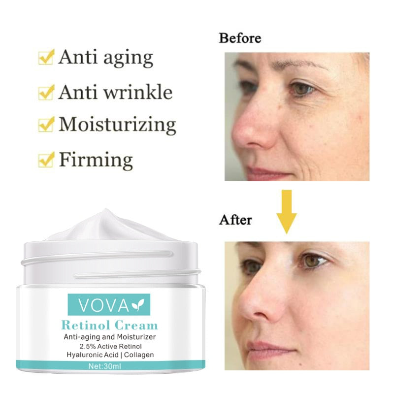 VOVA Retinol Anti Wrinkle Face Cream Collagen / Hyaluronic Acid  /  Retinol Improves Skin  tone /  FREE Shipping