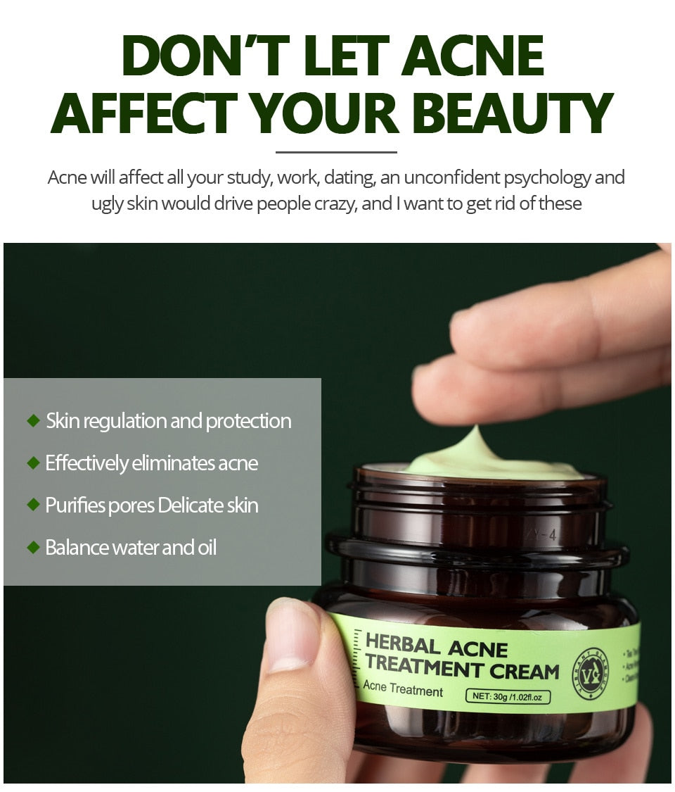 VIBRANT GLAMOUR Herbal Facial Skin Care 2PCS/Set Face Cream Serum Acne Treatment / FREE Shipping